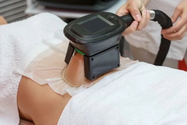 Image of person having fat freezing treatment to help weight gain Didcot