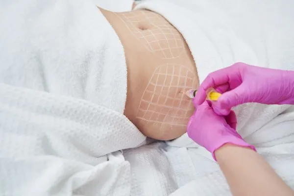 image of fat dissolving injections on love handles to help combat weight gain Didcot