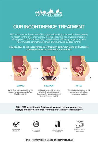 image to show how EMS treatment works for female urinary incontinence Didcot
