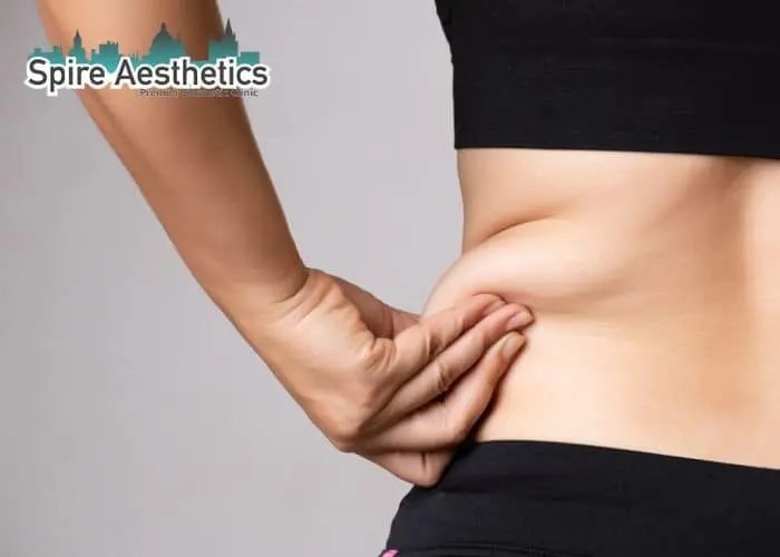 Image of woman pinching fat on their hips Didcot. Fat Freezing treatment