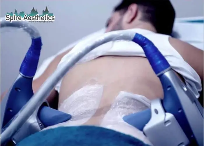 Man having fat freezing treatment done on love handles before a competitions Didcot to create a sculpted look.