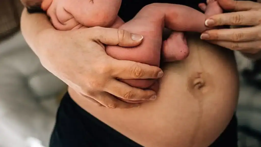 Why Is My Stomach Still Big After Pregnancy Didcot?
