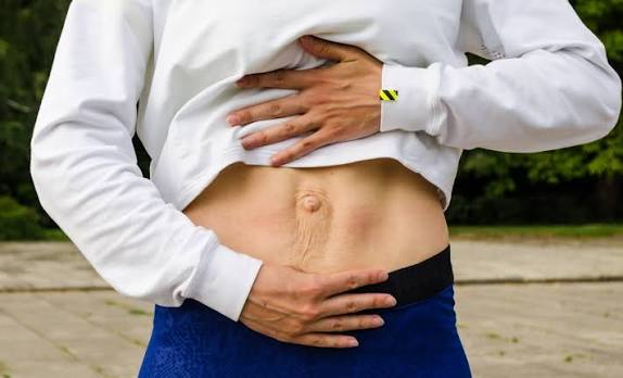 When Could Diastasis Recti Be the Missing Piece of the Puzzle Didcot?
